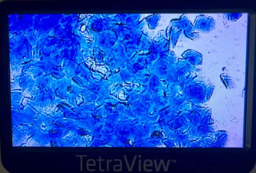 Cytology ovulation testing