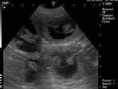 K9 ultrasound scanner